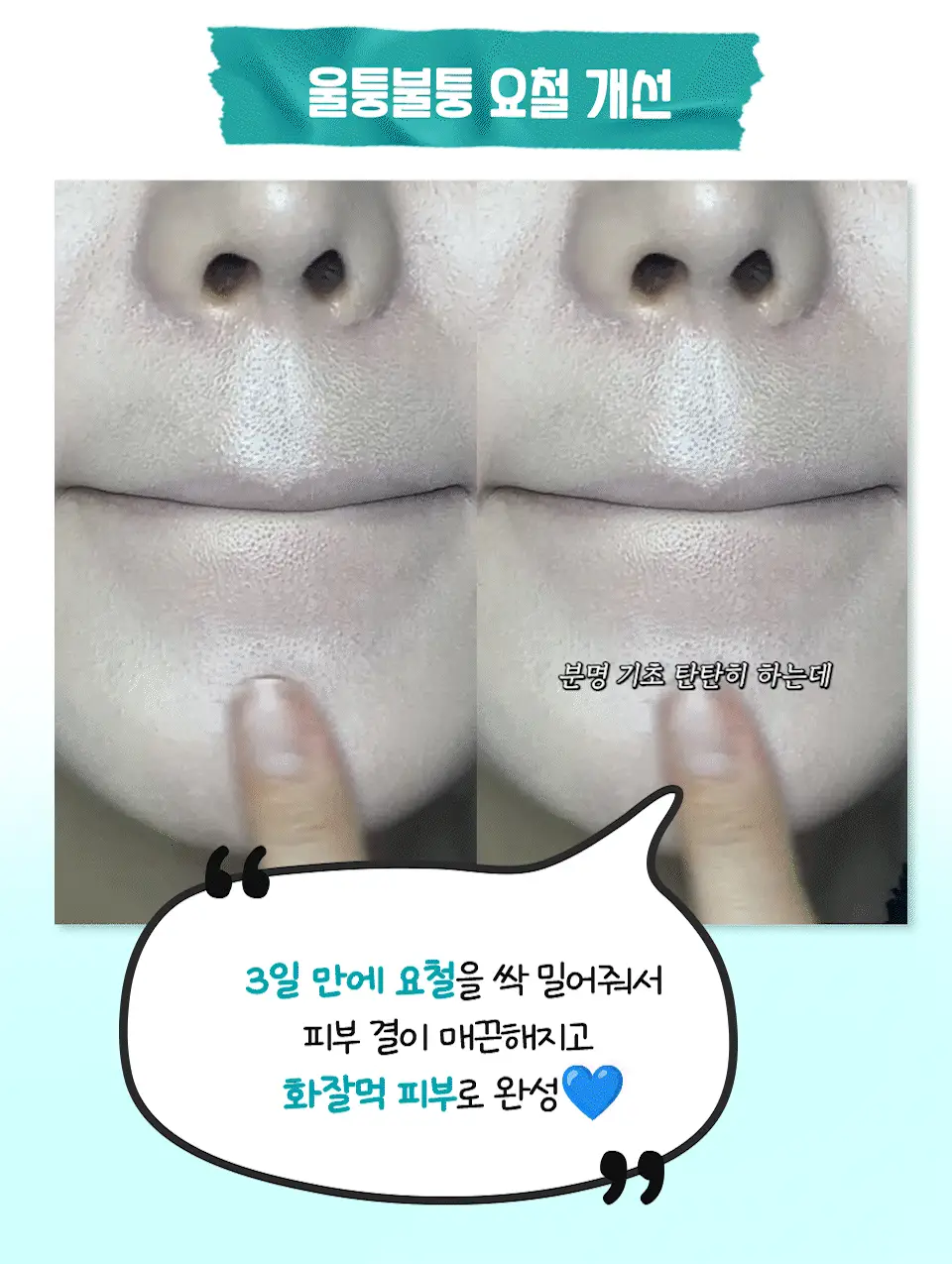 [대용량/흔적리셋] 아이소이 브라이트닝 카밍 스팟 세럼 35ml 리필 기획(+35ml) 상세페이지 7